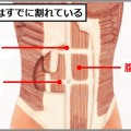 腹筋を割る…は間違いで「浮き出す」が正しい