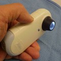 ダーモスコピー検査の自己負担額は数百円ほど