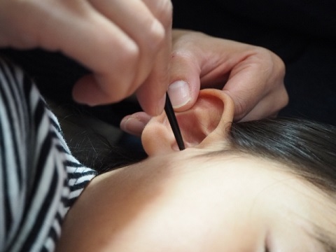 耳くそ掃除は耳鼻科医のほとんどがやっていない
