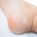 かかとのガザガザはクリームの塗り方で激変する