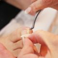 巻き爪の治し方は足の指を使ったウォーキング
