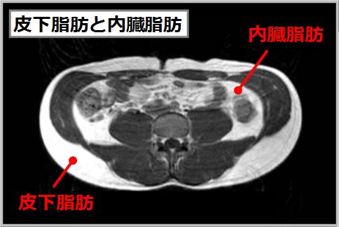 皮下脂肪を落とす「8秒筋トレ」のやり方とは
